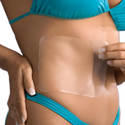 Biodermis Scar Aid Lamina de Silicón 14.5 x 12cm - Diebe Pharma