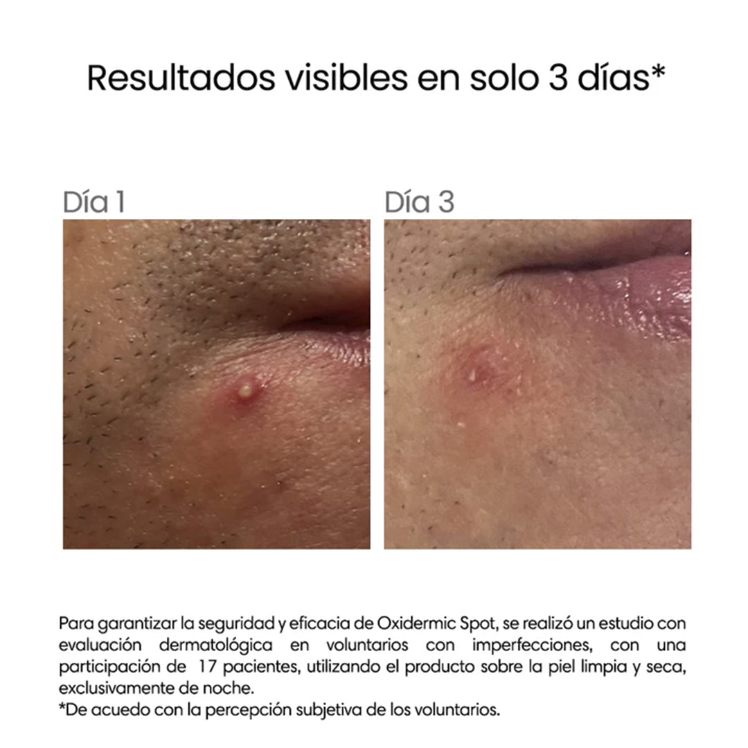 Reve_Oxidermic_Spot_2.jpg