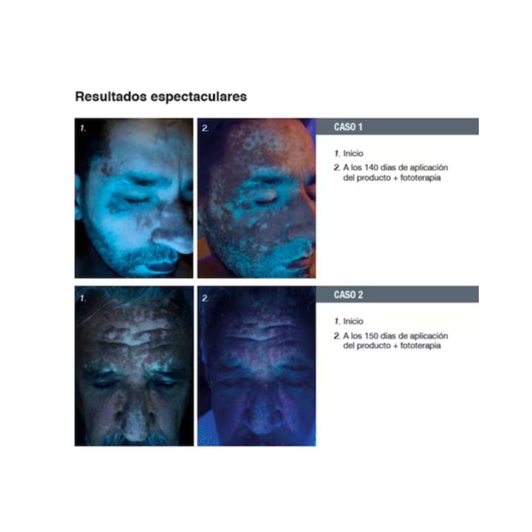 diebepharma_51_aadf7aaa-b9c4-4b2f-80d6-311592c590e4.png