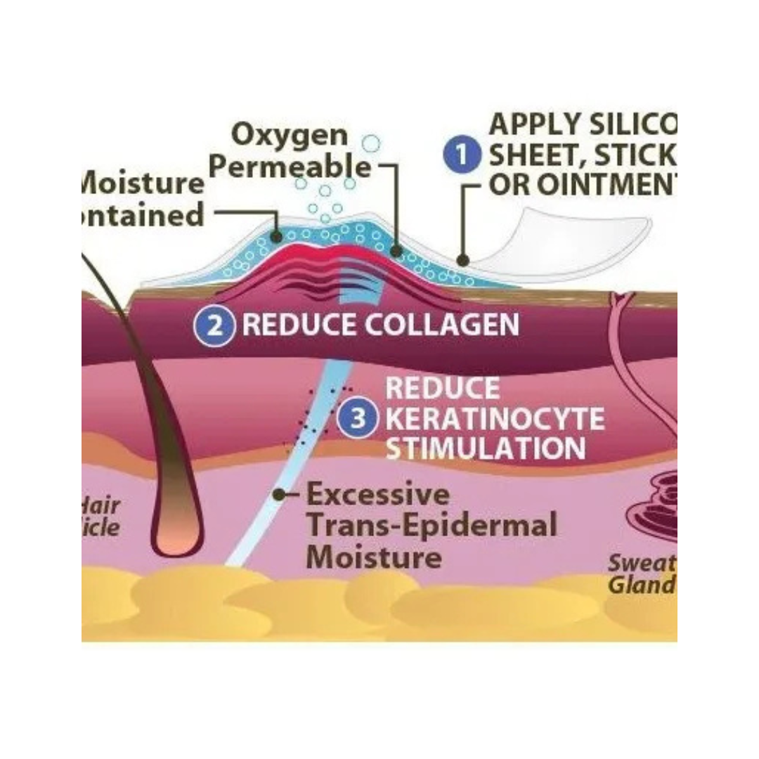 diebepharma_51_f546f283-6021-4c3b-9bdb-fef6c3b9ea34.png